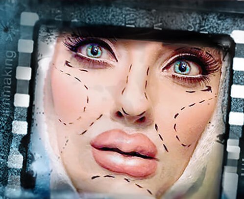 Professionele FX Wond - Botox Lippen